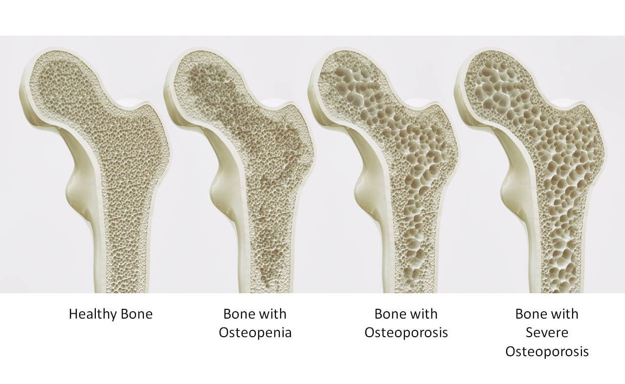 The Bridge Within : Why Collagen Matters More as We Age